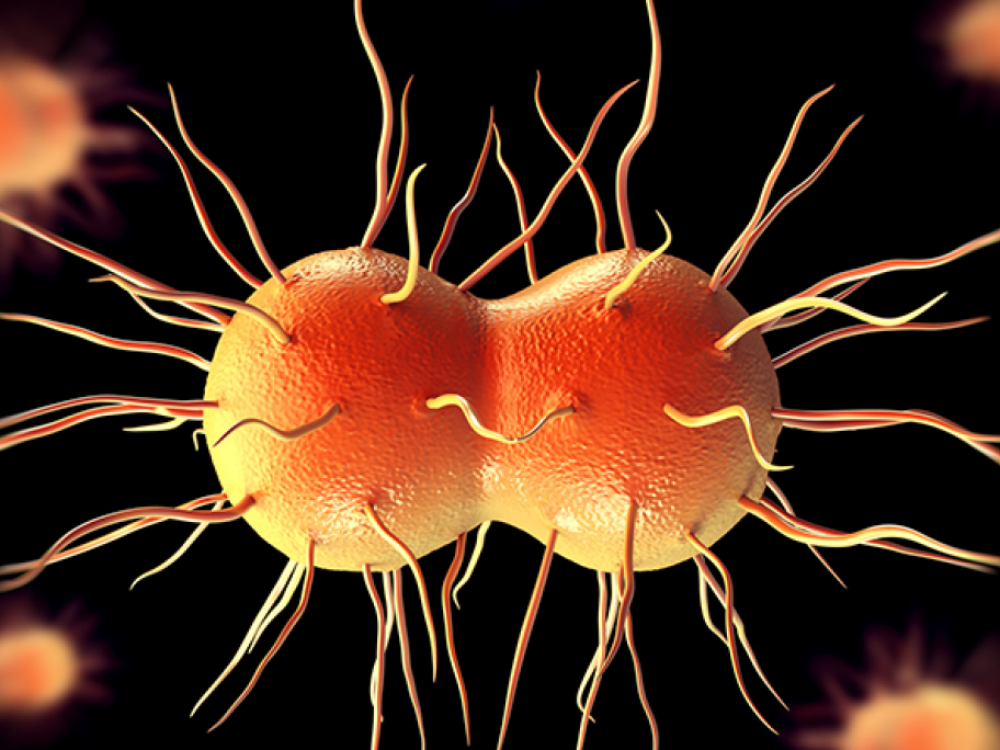 gonorrhoea