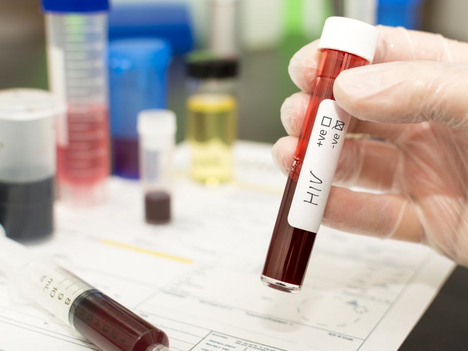 HIV blood test