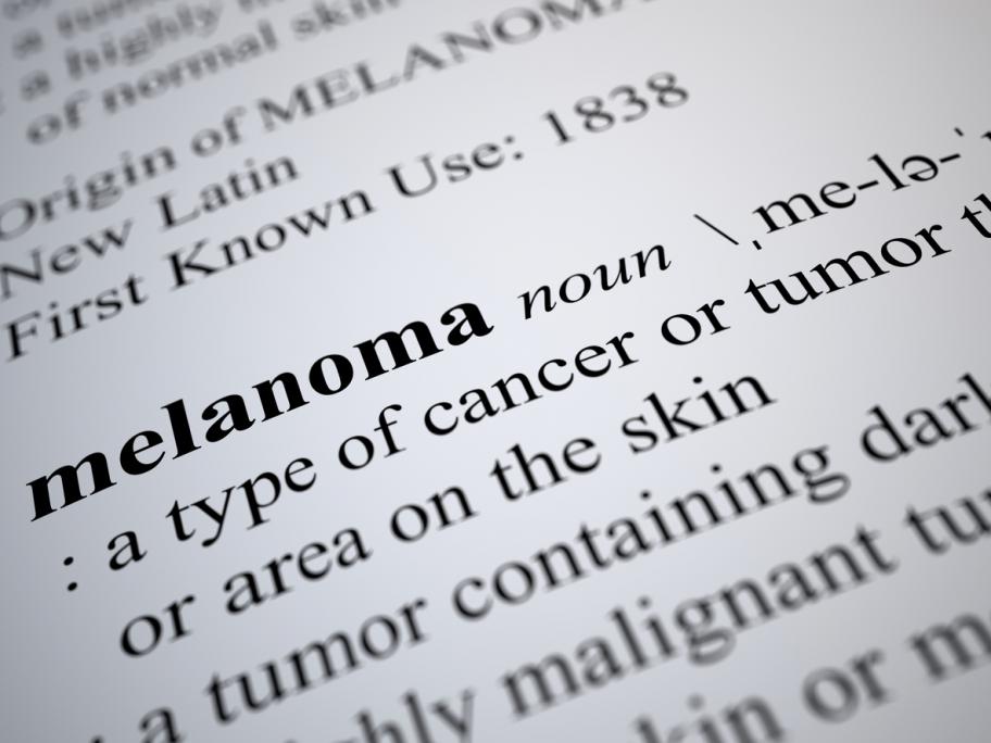 Melanoma