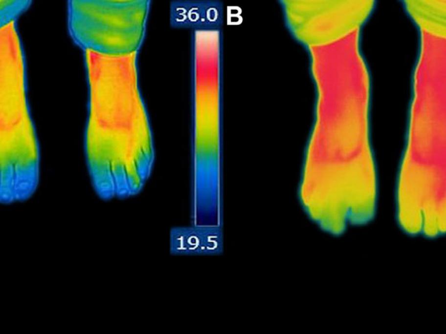 Cold feet