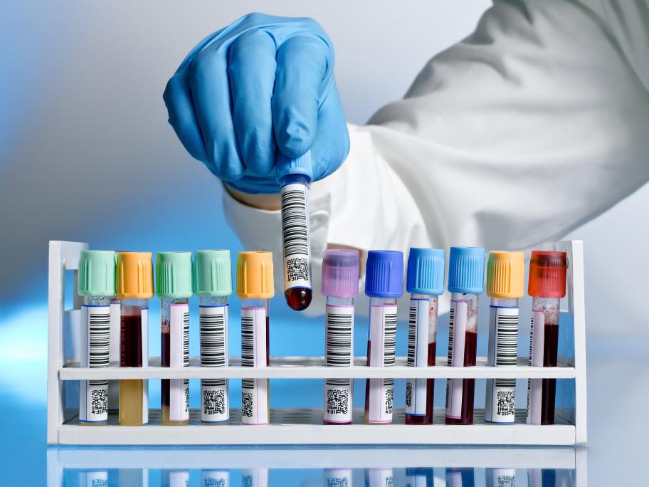 Doctor with test tubes