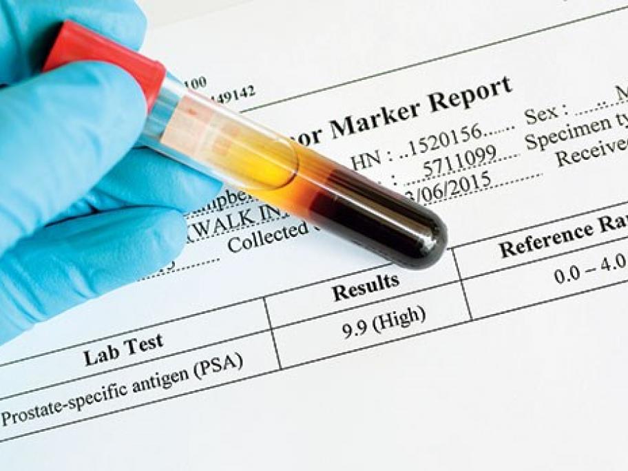 One Off Psa Test May Do More Harm Than Good Largest Study To Date Shows Australian Doctor Group One Off Psa Test May Do More Harm Than Good Largest Study To Date Shows Australian Doctor Group