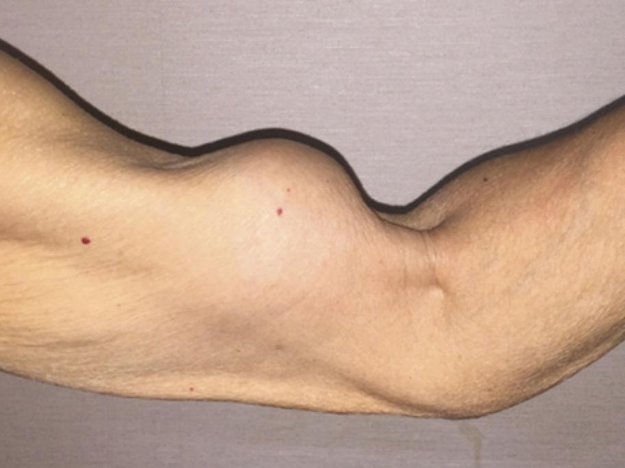 Arm