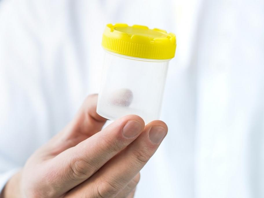 urine test