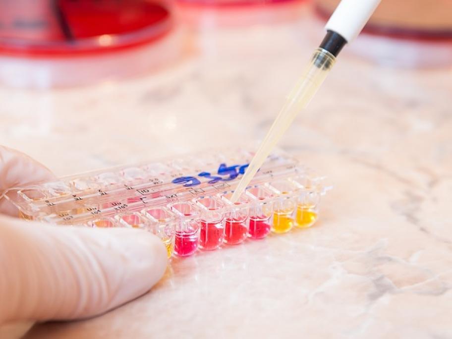 Testing urine