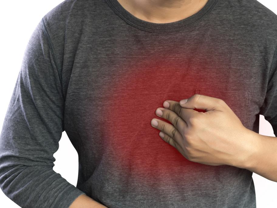 acid reflux