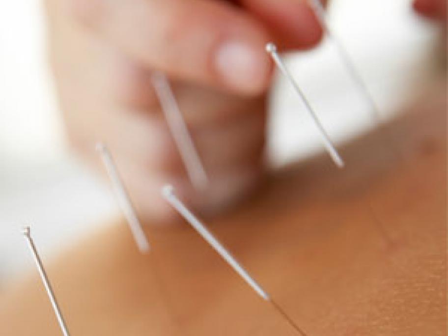 Acupuncture