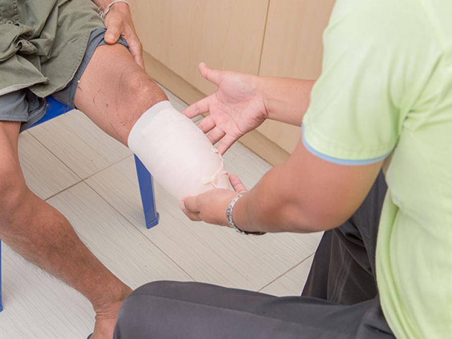 man with a below the knee amputation
