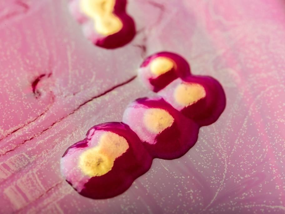 bacteria petri dish