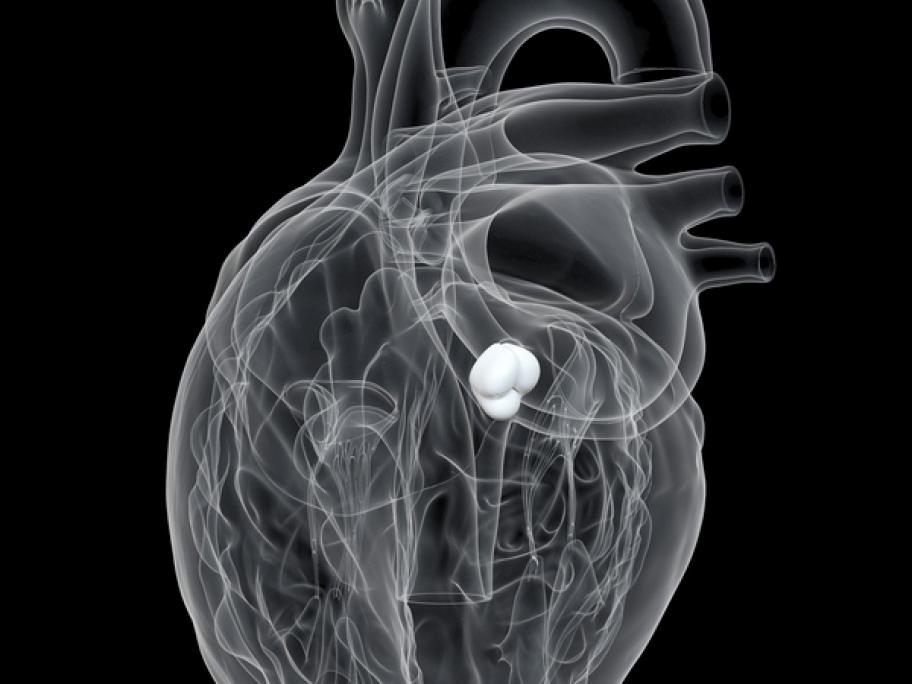 aortic valve