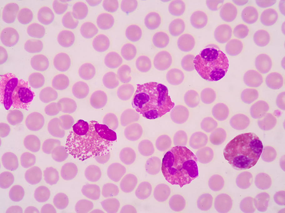 blood with eosinophils