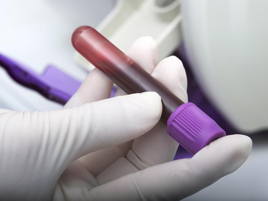 phlebotomist holding vial of blood