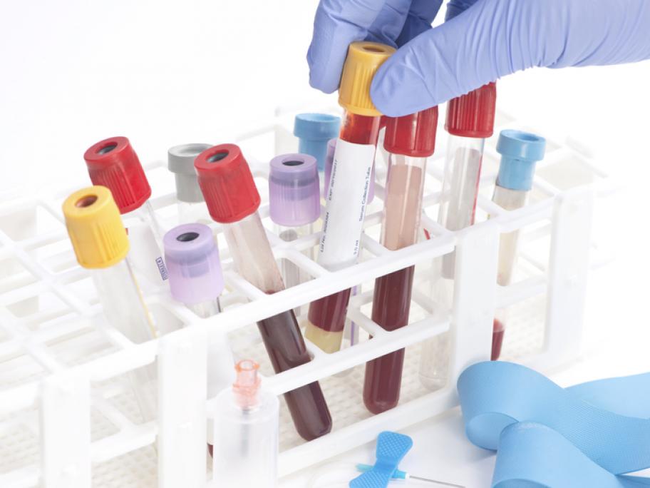 blood tests
