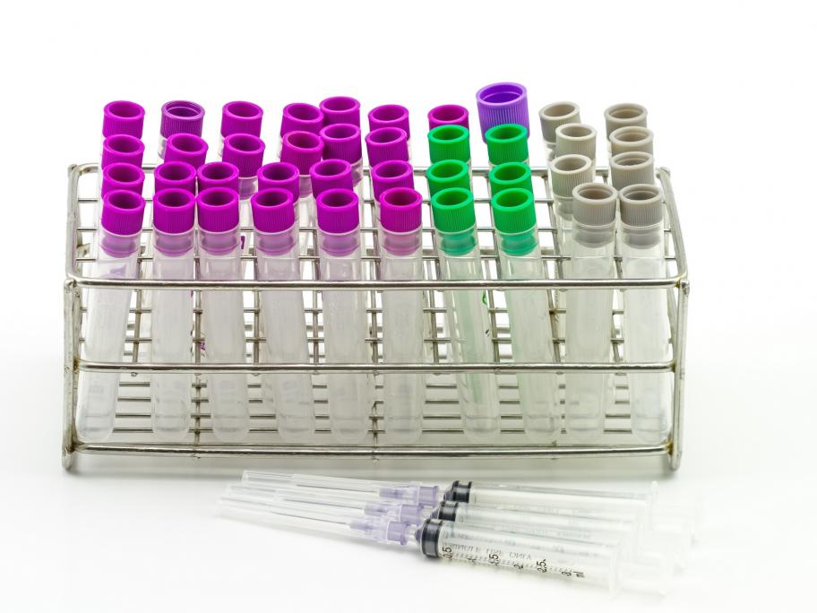 Gene test
