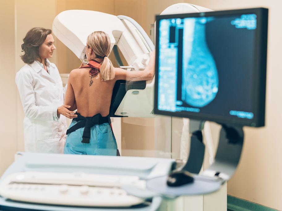 Breast screening