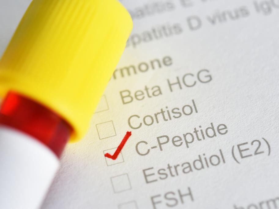 Vial of blood to be tested for C-peptide