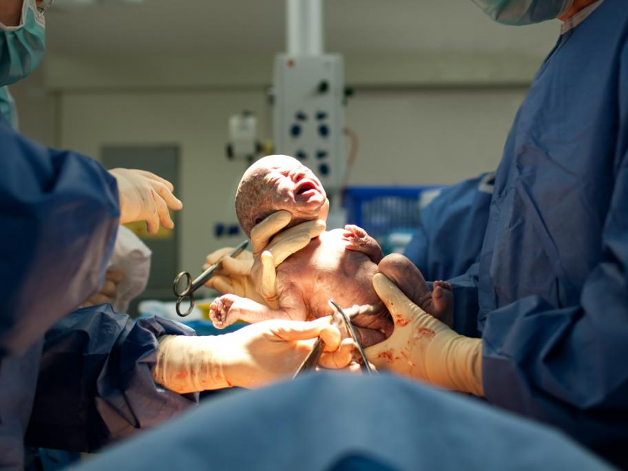 doctors holding baby just born by caesarian section