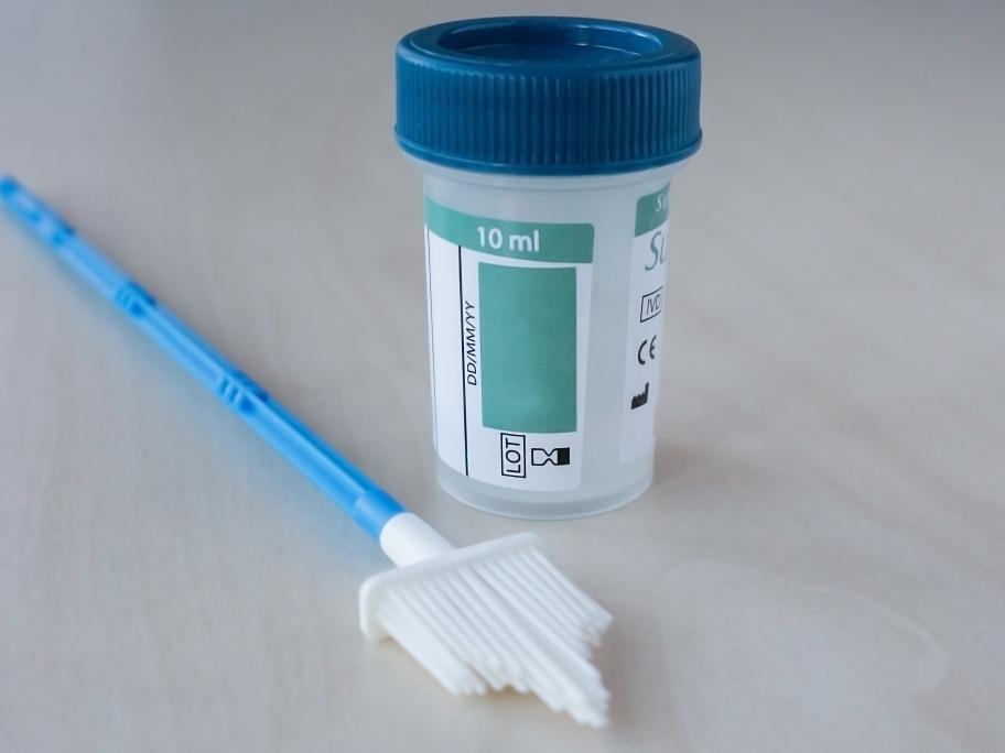 cervical smear