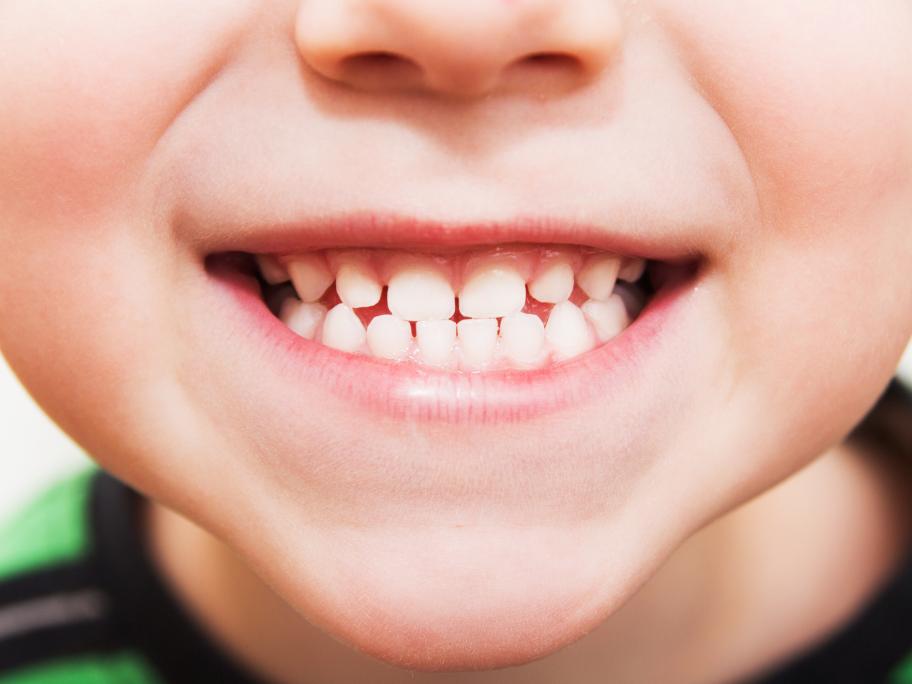 Child's teeth