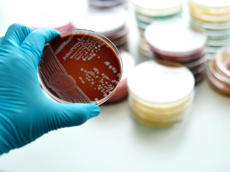 Why a bizarre, decades old case report about chocolate agar is enjoying a resurgence