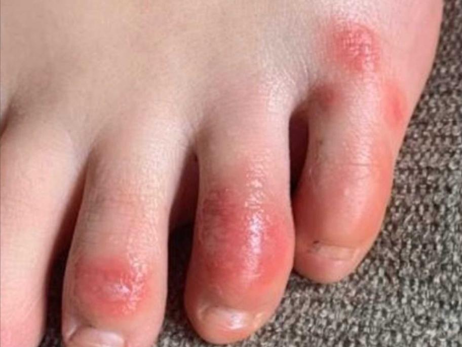 Toes