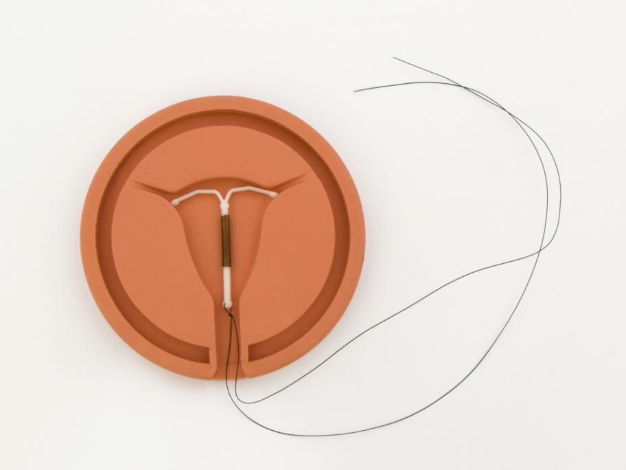 Copper IUD