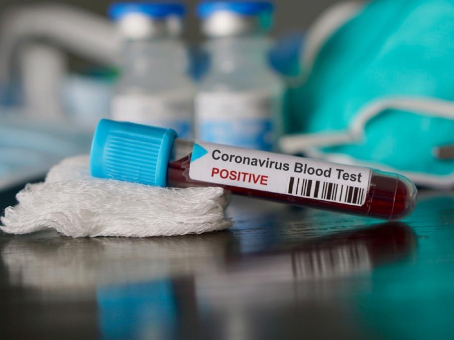 Blood test coronavirus
