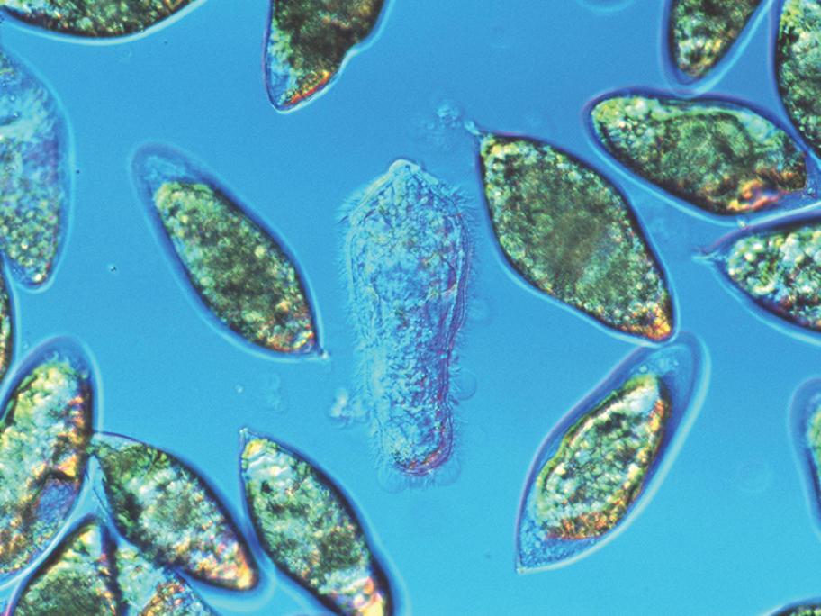 Schistosomiasis