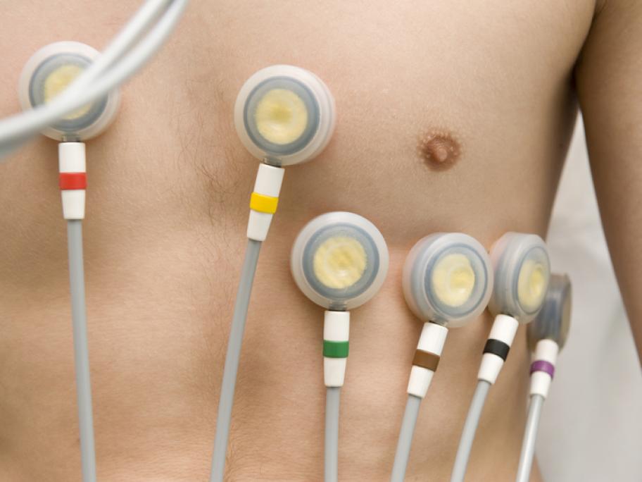 Man's chest with ECG leads attached
