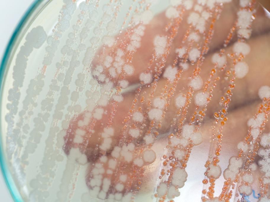 Enterobacteriacae on agar plate
