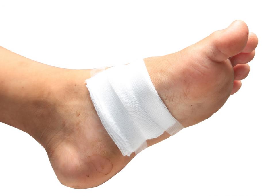 foot ulcer