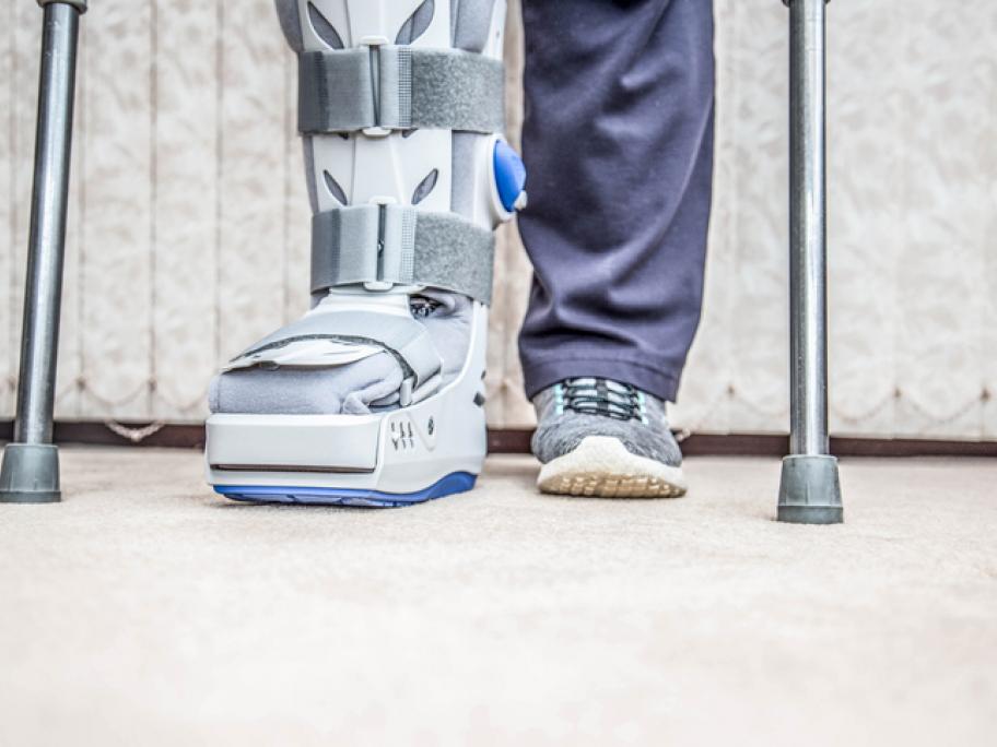 Fractured foot in splint