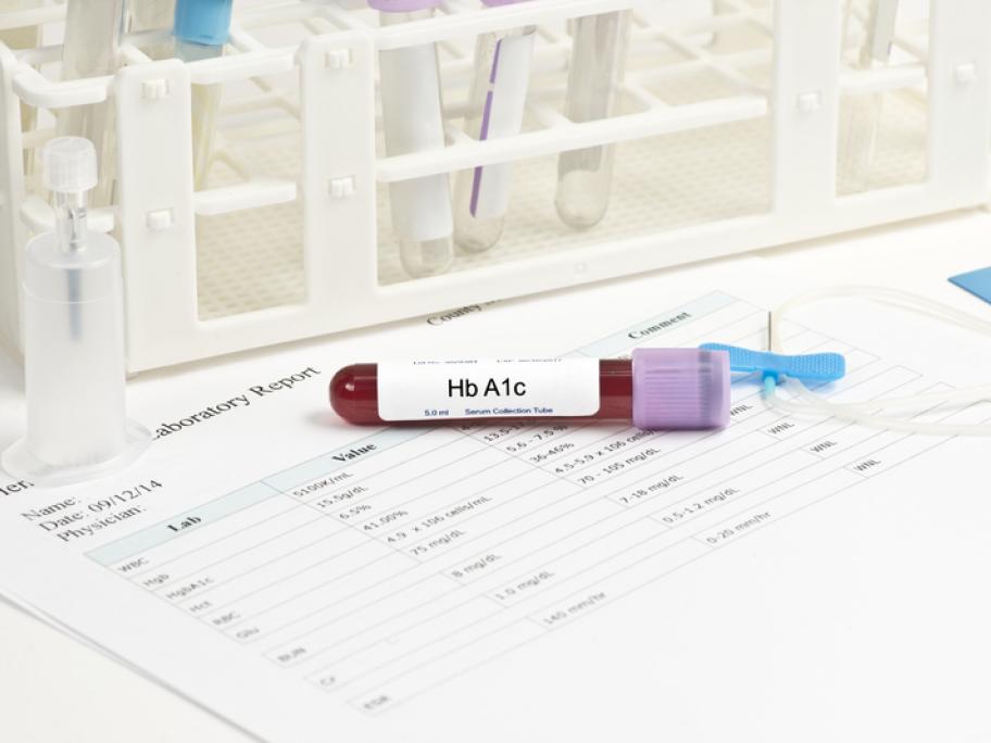 Vial of blood for HbA1c test