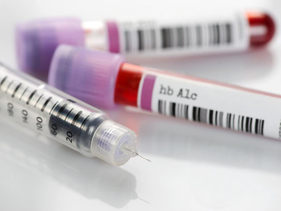 Vial of blood for measuring HbA1c