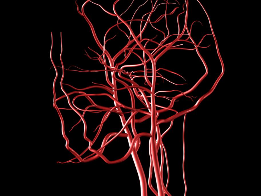 head and brain arteries