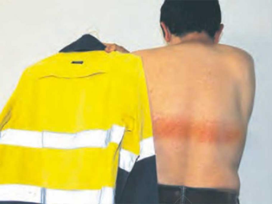 Hi-vis burn