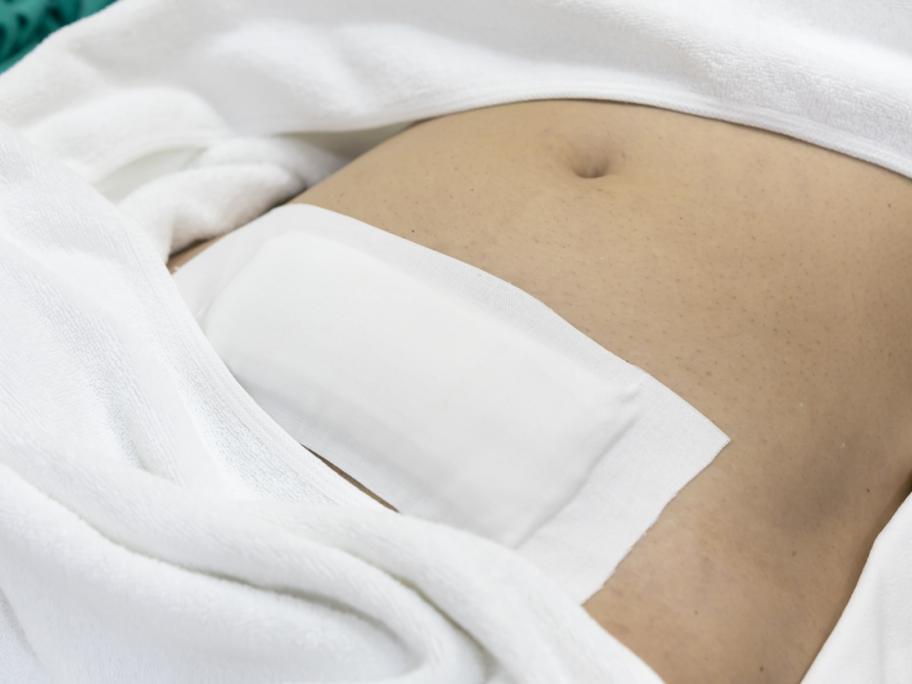 Hysterectomy
