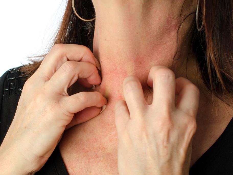 Woman with itch