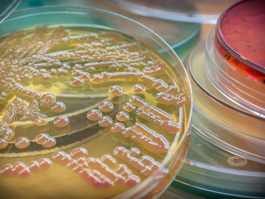 Klebsiella pneumoniae