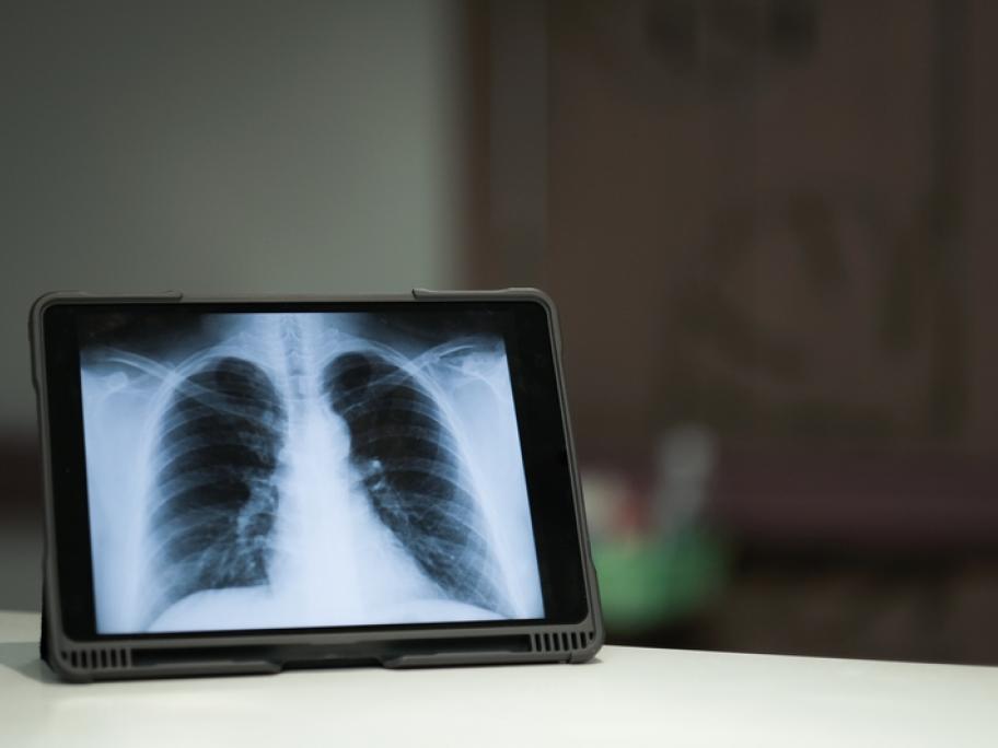 Lung imaging