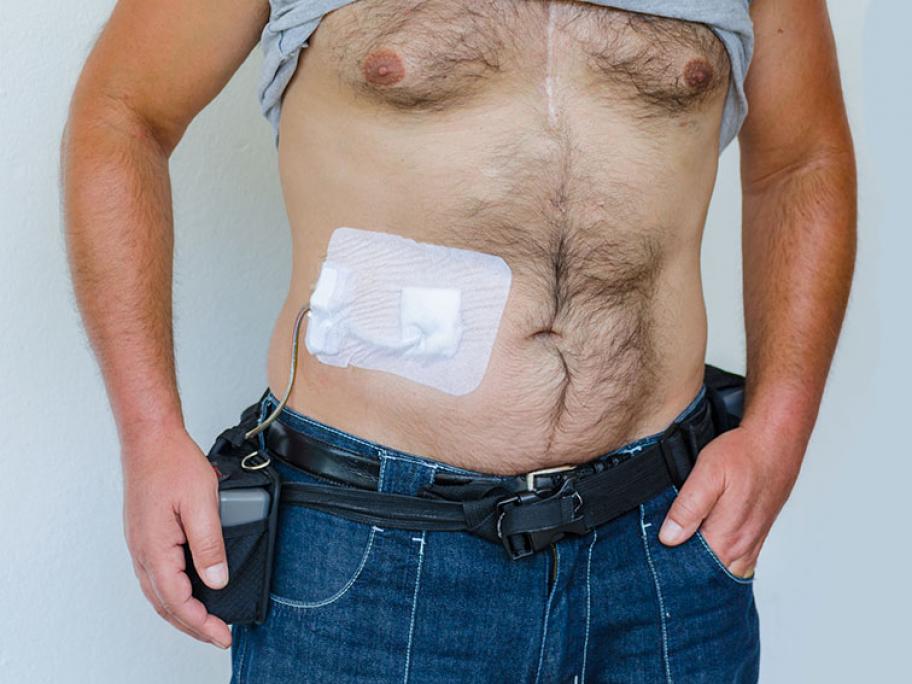 LVAD