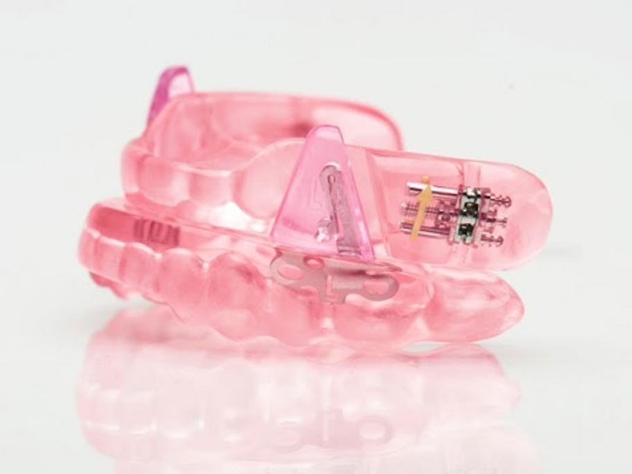 mandibular advancement device