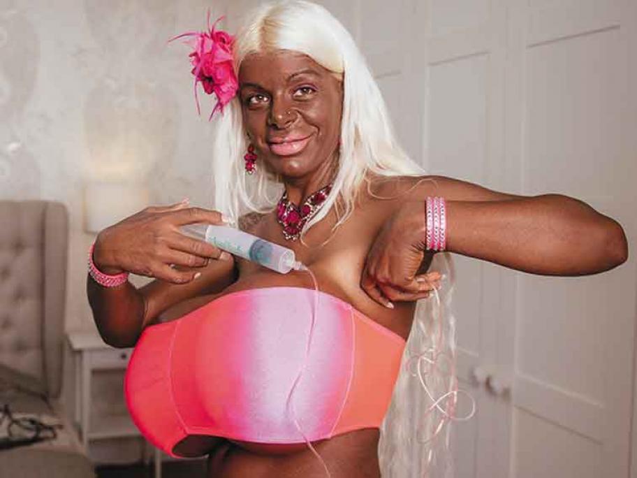 Woman tanned with melanotan