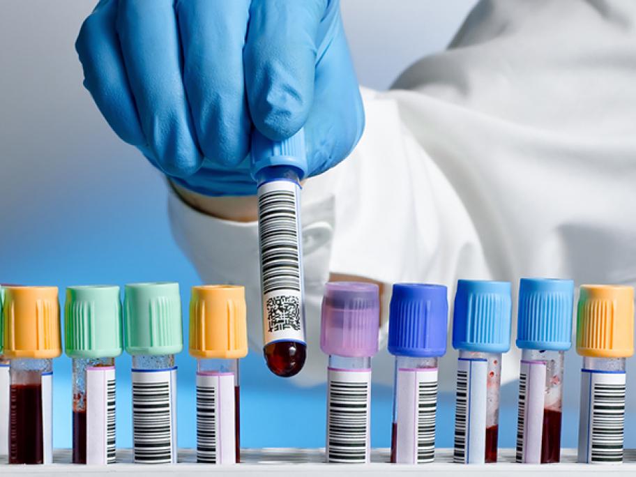 test tube