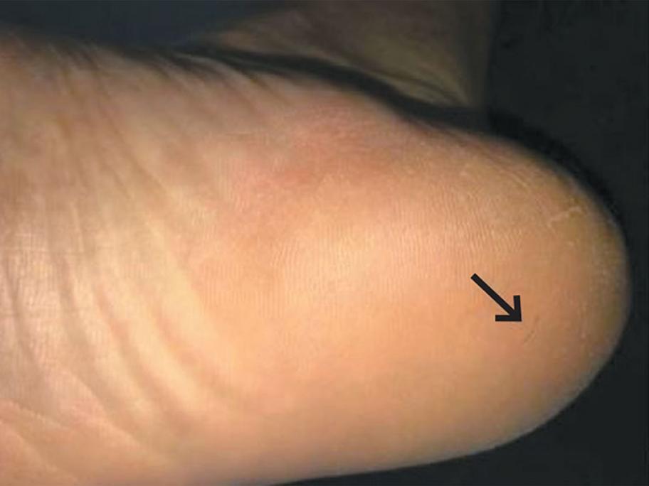 Hair splinter