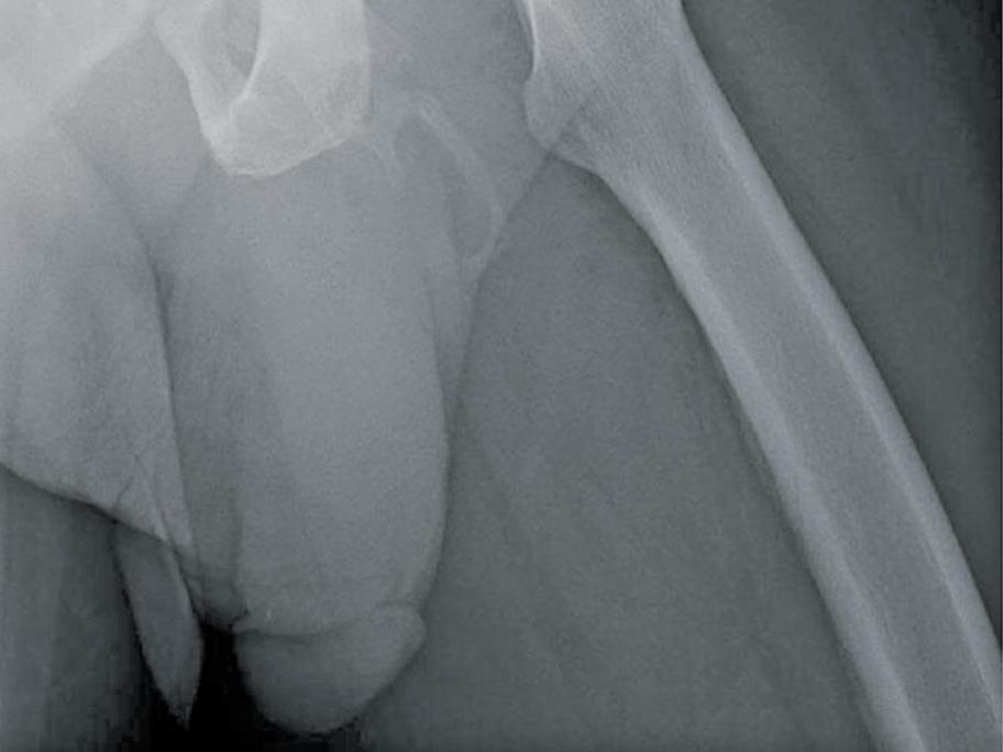 X-ray