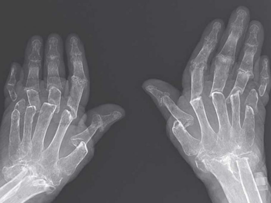 X-ray