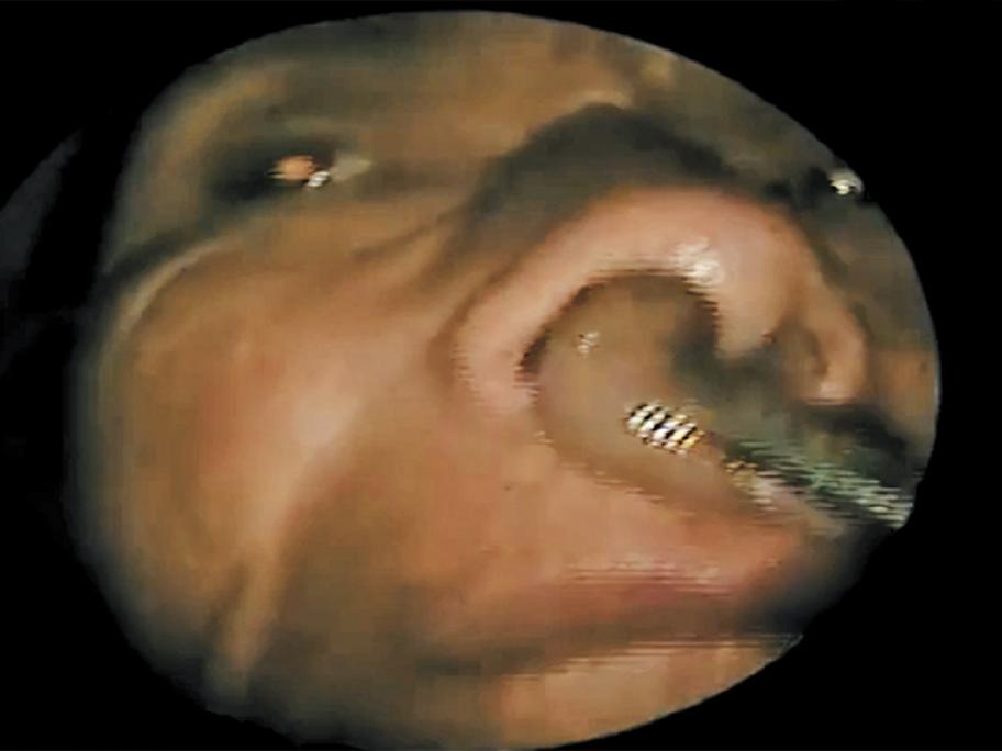 Leech