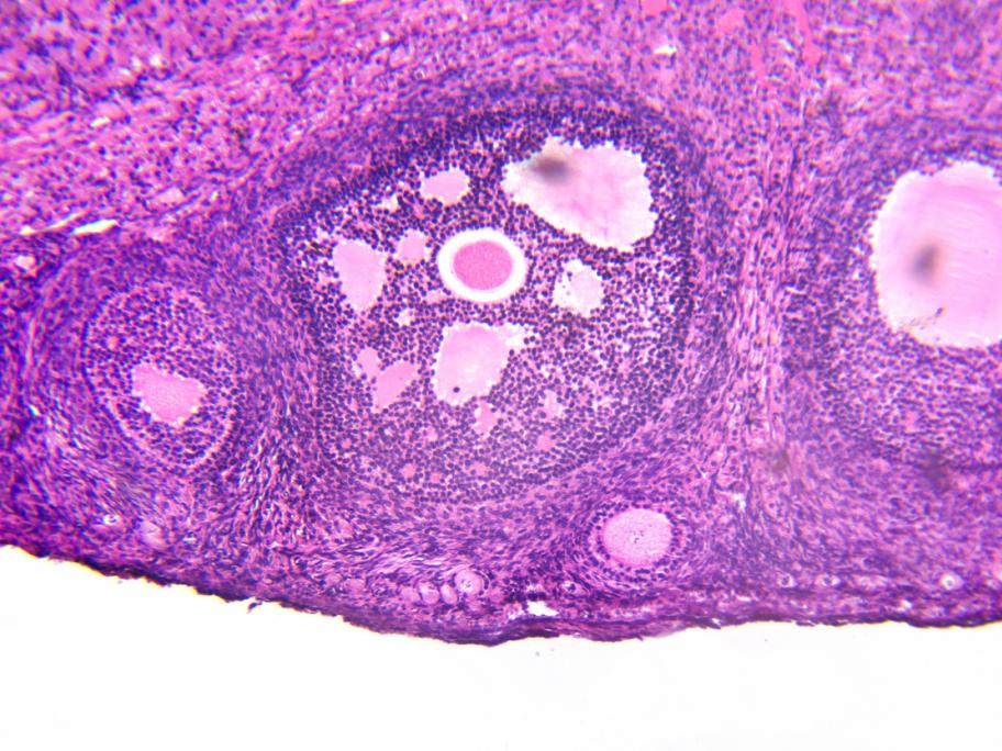 Histology of ovary with developing follicles