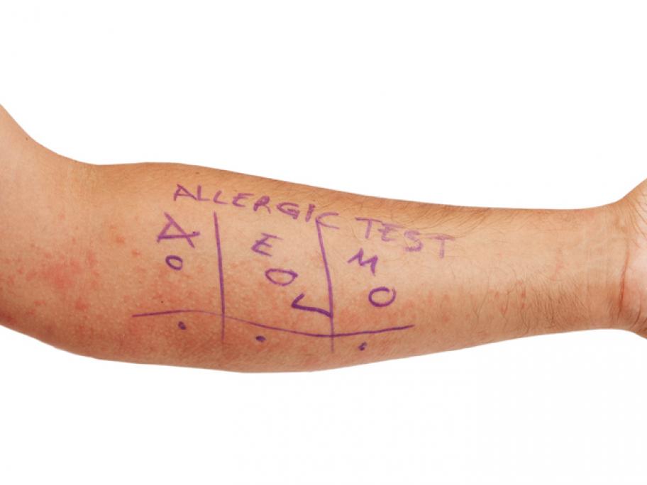 Patch test